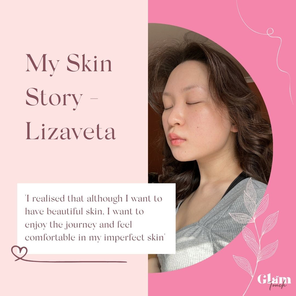 My Skin Story - Lizaveta