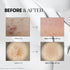 VT COSMETICS Reedle Shot 100 - 50ml