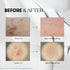 VT COSMETICS Reedle Shot 300 - 50ml