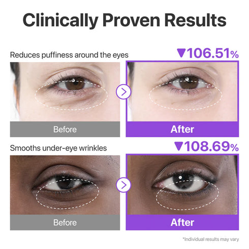 Numbuzin No.9 NAD Collagen Under Eye Patches (5 Pairs)