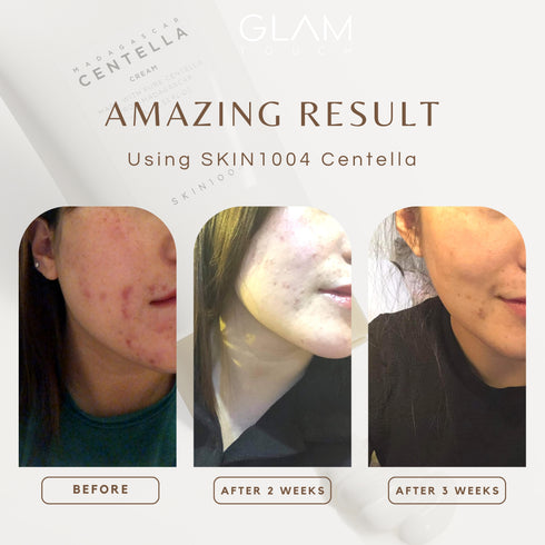 SKIN1004 Madagascar Centella Travel Kit 5 Types